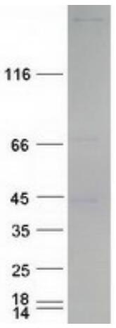 Coomassie blue staining of purified EIF4G1 protein. The protein was produced from HEK293T cells transfected with EIF4G1 cDNA clone using MegaTran 2.0.